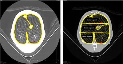 Computed Tomography Assessment of Tidal Lung Overinflation in Domestic Cats Undergoing Pressure-Controlled Mechanical Ventilation During General Anesthesia